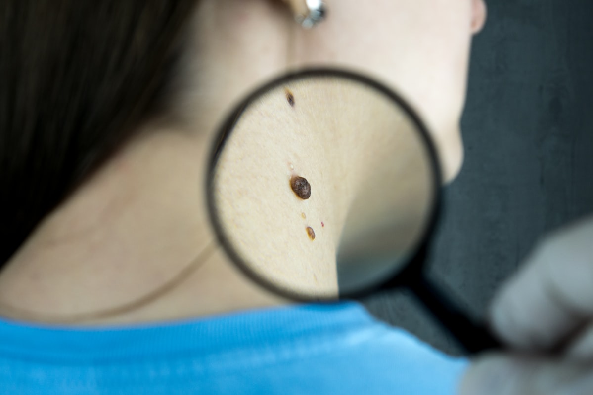 Stress, hormona e inflamação cutânea: a tríade invisível
